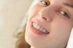What Are Clear Aligners and How Do They Work?