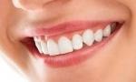 How Much Does Digital Smile Design Cost?