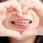 What Are the Different Types of Braces?
