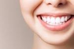 Is Laser Teeth Whitening Worth It?