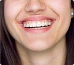 Who Is a Good Candidate for Gum Contouring?