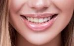 Can I Remove Coffee and Tea Stains from My Teeth?