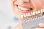 How Often Should You Use Nano Teeth Whitening?