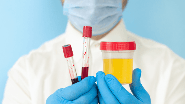 How to Read Candida Test Results Without Confusion