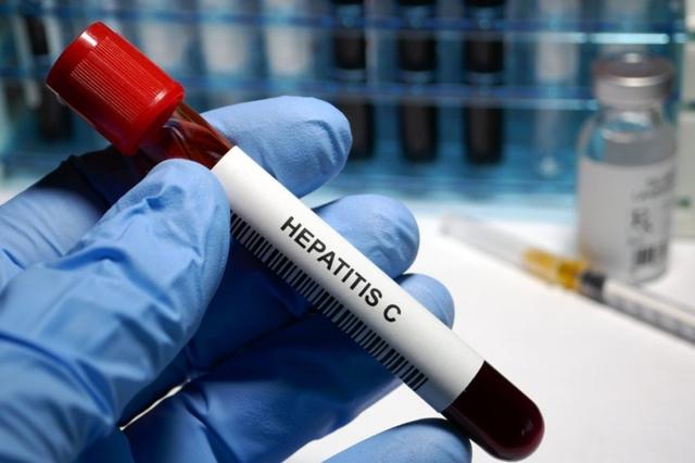 How Reliable Is a Rapid Hepatitis C Test?